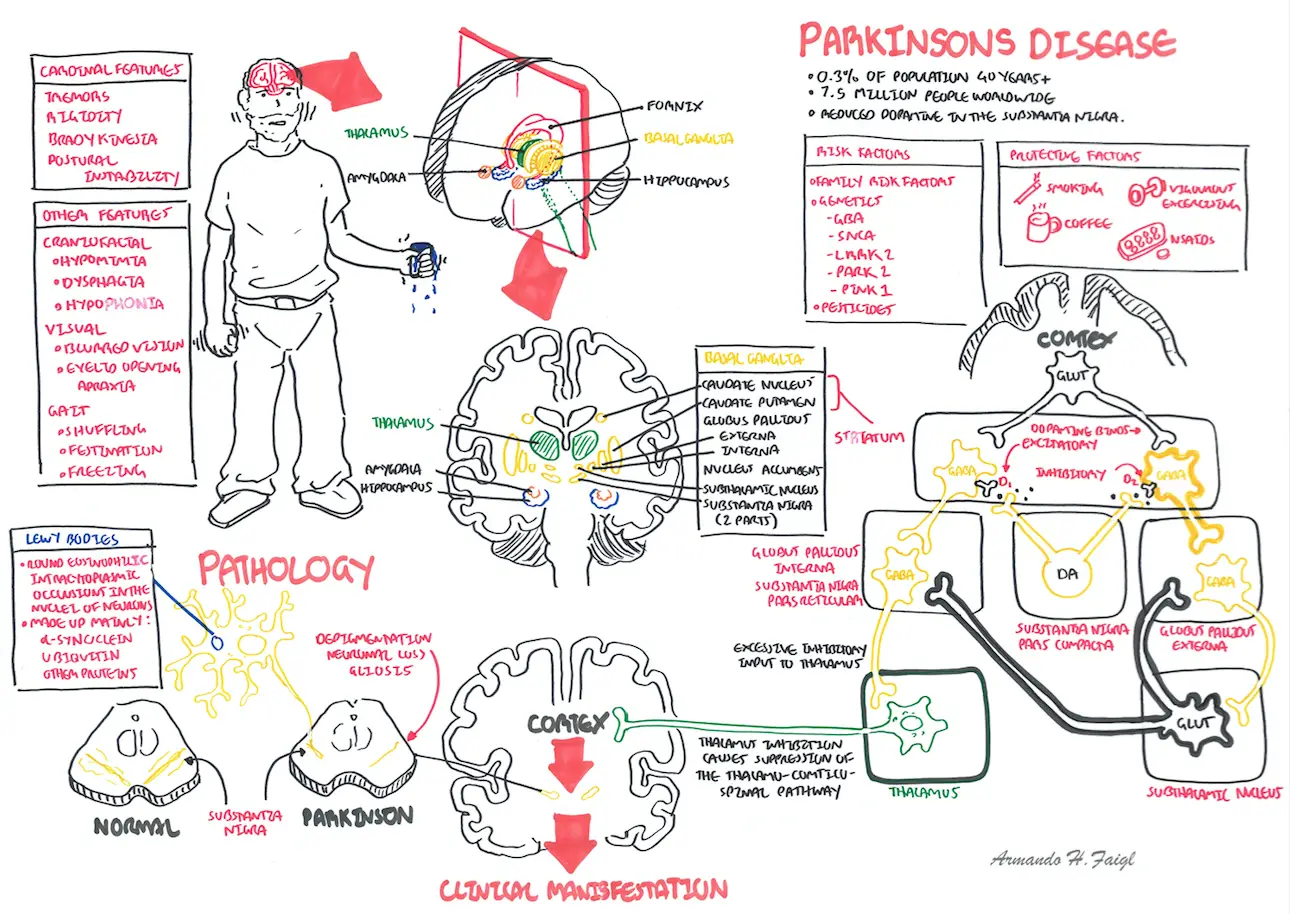 Durerea articulară a bolii Parkinson
