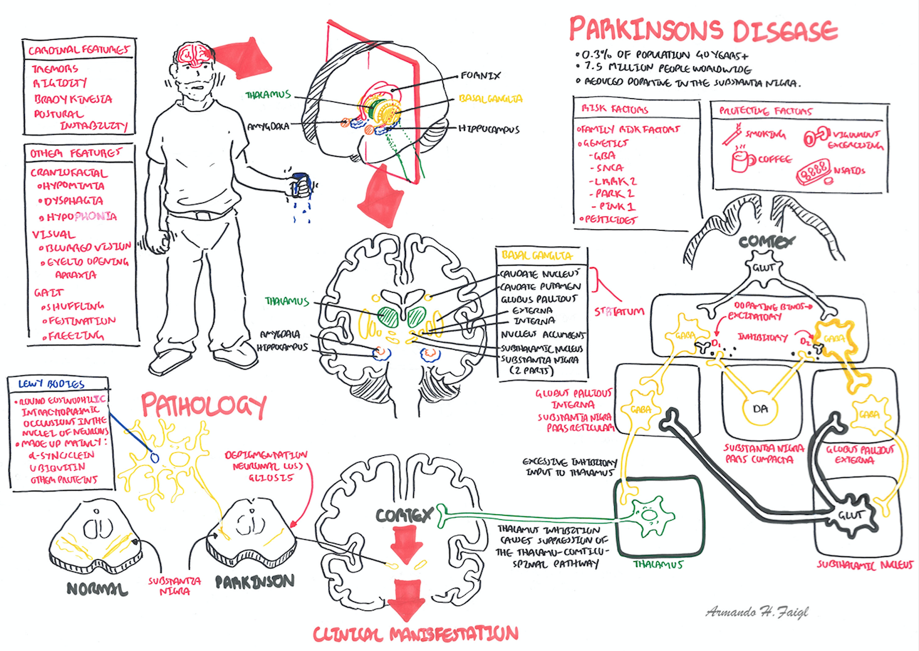 Dureri articulare Parkinson