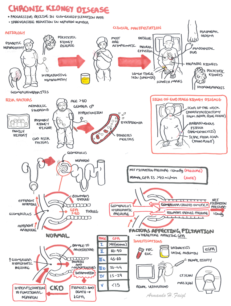 Acute Renal Failure Vs Chronic Renal Failure Chart