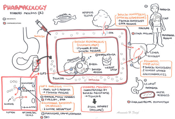 Diabetes Mellitus Type II - Armando Hasudungan