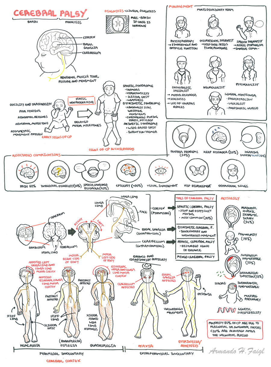 Cerebral Palsy | Armando Hasudungan