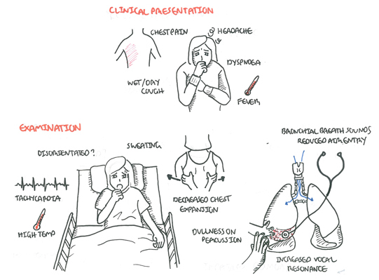 Community Acquired Pneumonia Armando Hasudungan