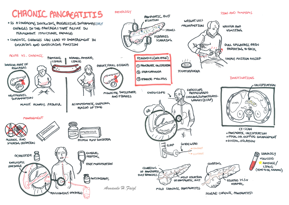 Chronic Pancreatitis | Armando Hasudungan