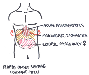 nephrolithiasis investigations