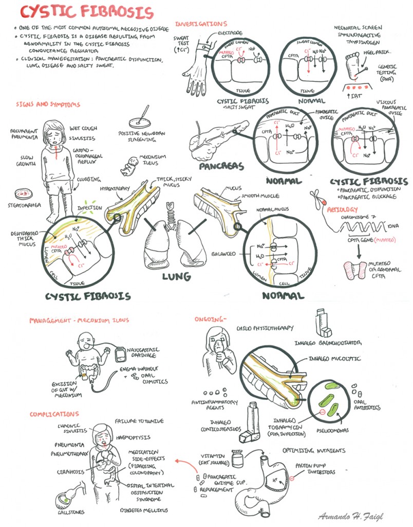 cystic fibrosis