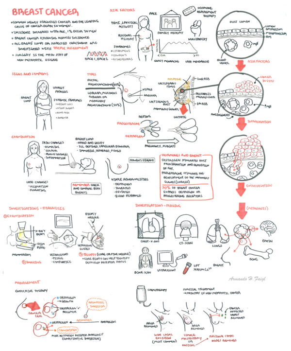 Breast Cancer - Armando Hasudungan