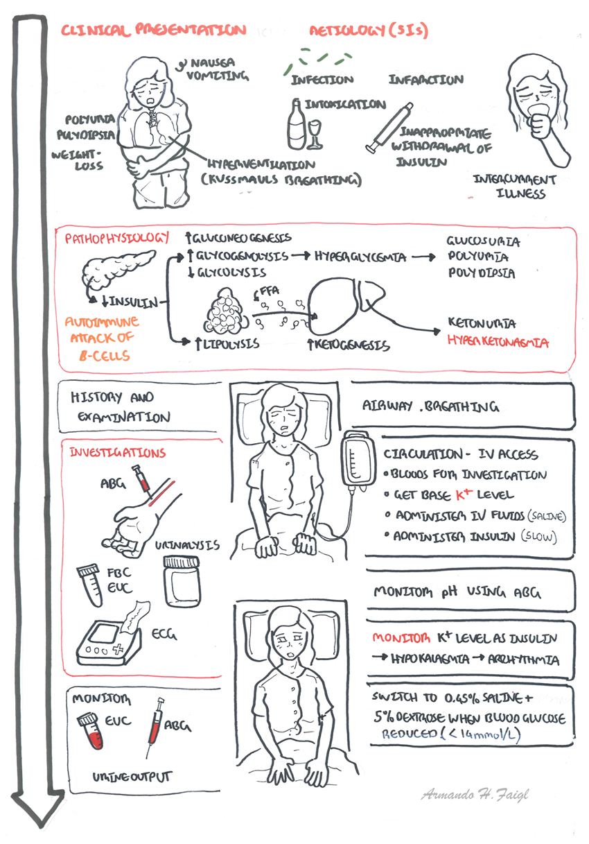 clinical presentation of diabetic ketoacidosis