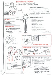 urinary retention acute