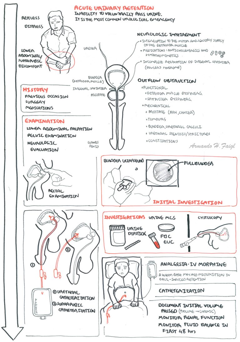 Acute Urinary Retention – Armando Hasudungan