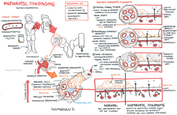 Nephrotic Syndrome - Armando Hasudungan