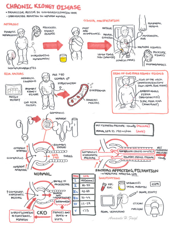 Chronic Kidney Disease - Armando Hasudungan