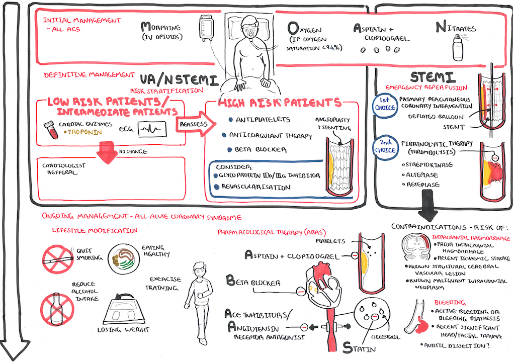 Angina Pectoris Armando Hasudungan