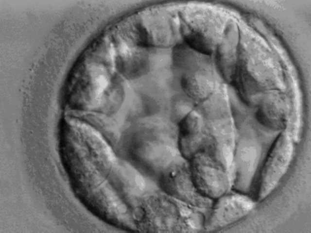 Microscopic image of a blastocyst five days after fertilisation.