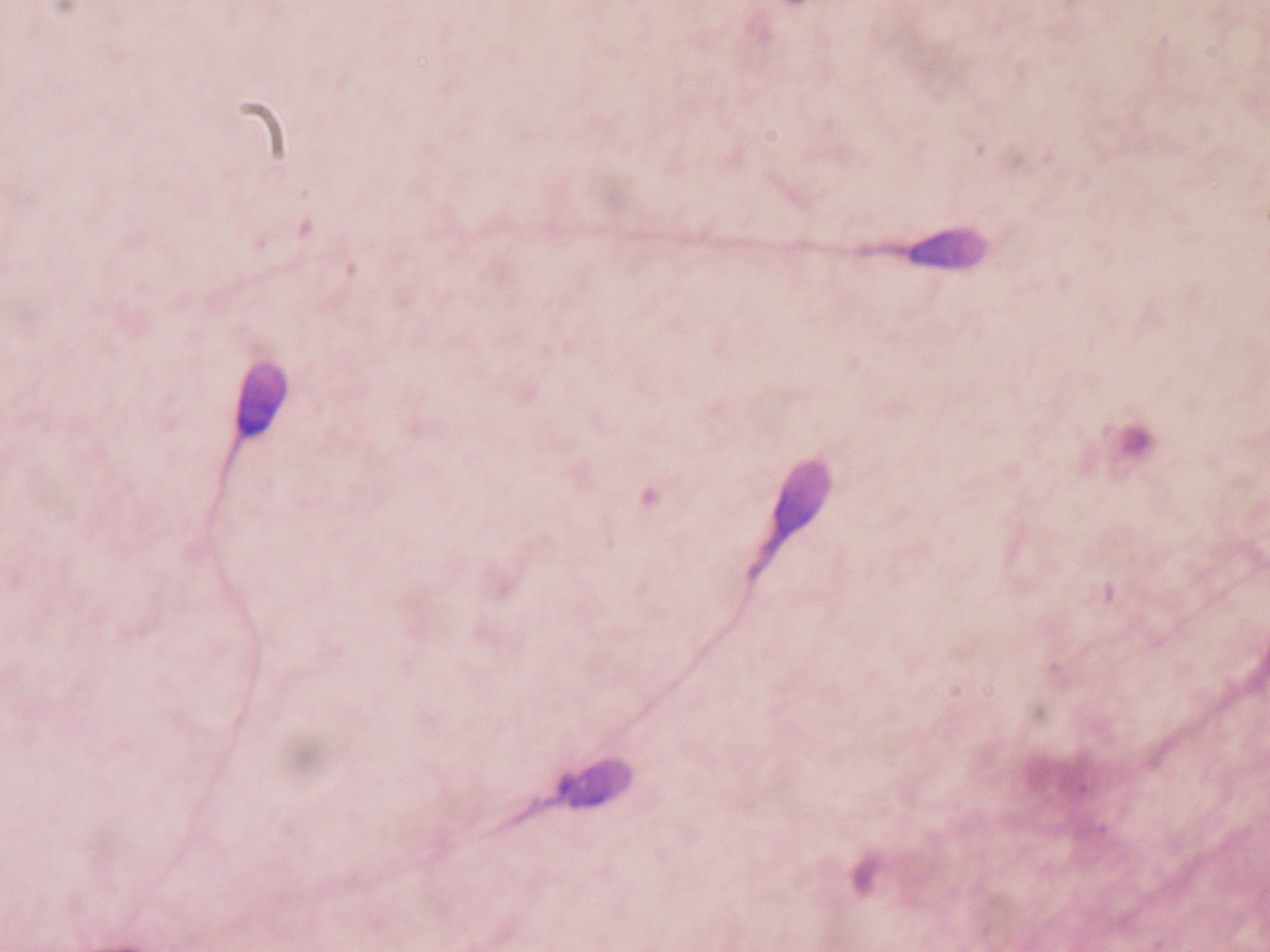 Microscopic view of stained human spermatozoa used for semen-quality assessment.