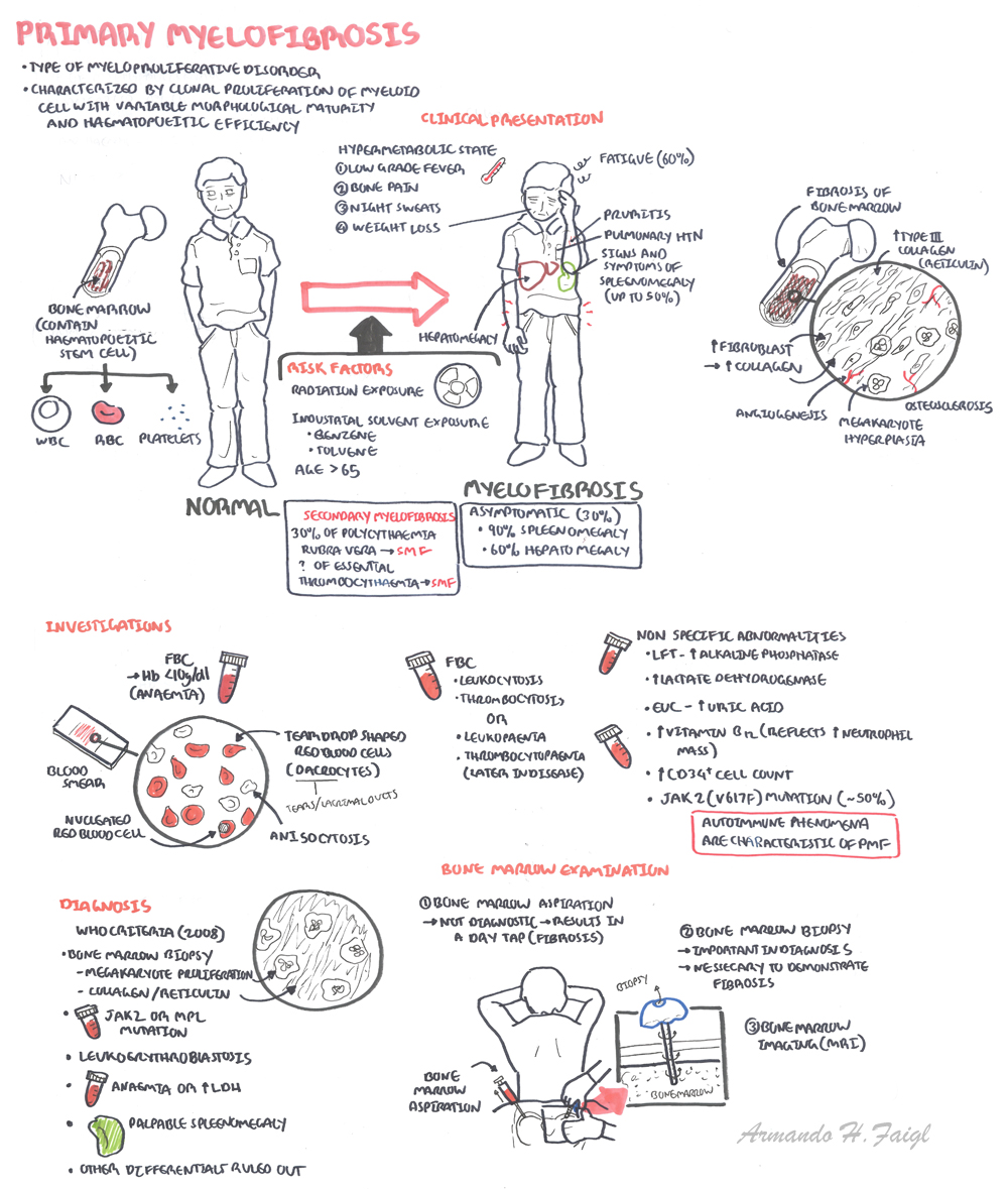 Myelofibrosis - Armando Hasudungan