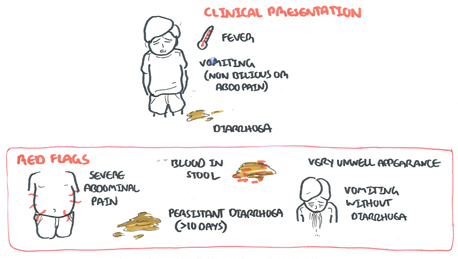 Gastroenteritis (Infectious Diarrhoea) | Armando Hasudungan