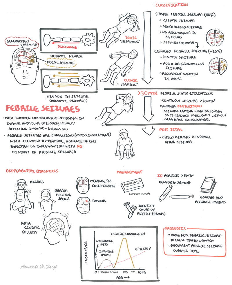 febrile seizure