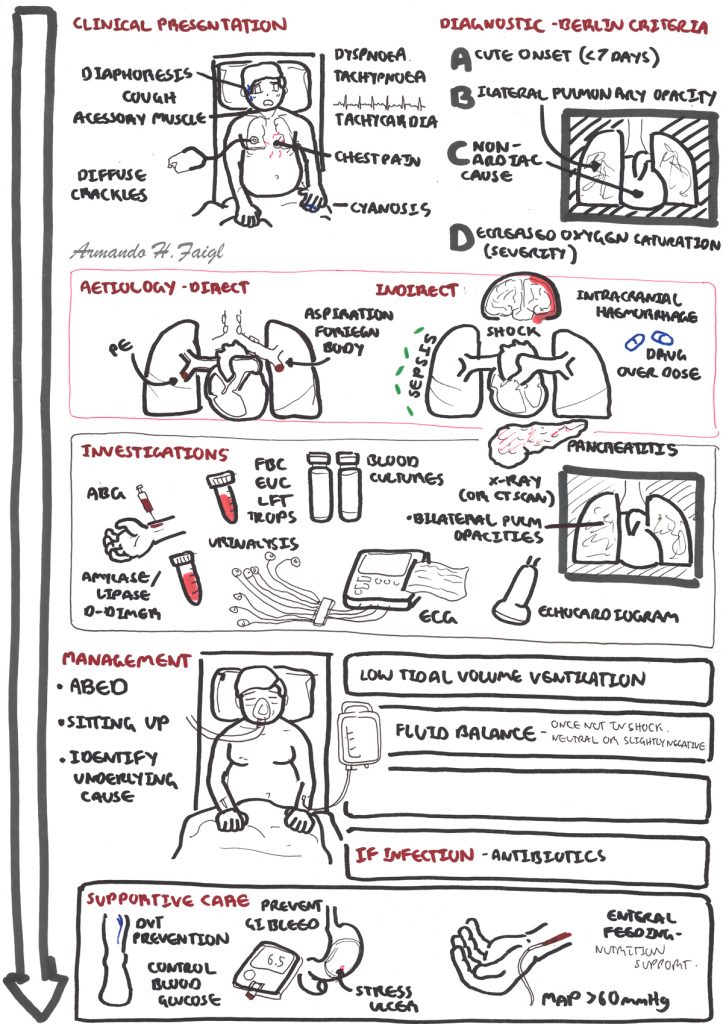 Acute Respiratory Distress Syndrome - Armando Hasudungan