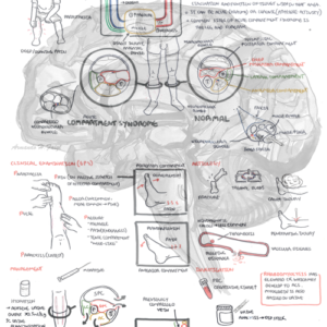 Acute Compartment Syndrome - Personal use