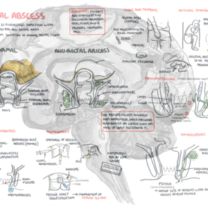 Ano-rectal Abscess - Personal use