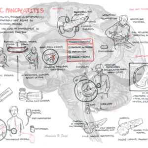 Chronic Panreatitis - Personal use