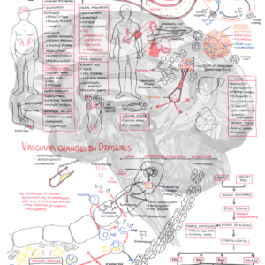 Diabetes Complications Pathophysiology - Personal use