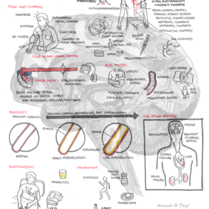 Hypertension Overview - Personal use