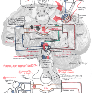 Pulmonary Circulation and Hypertension - Personal use