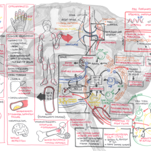 Rheumatoid Arthritis - Personal use