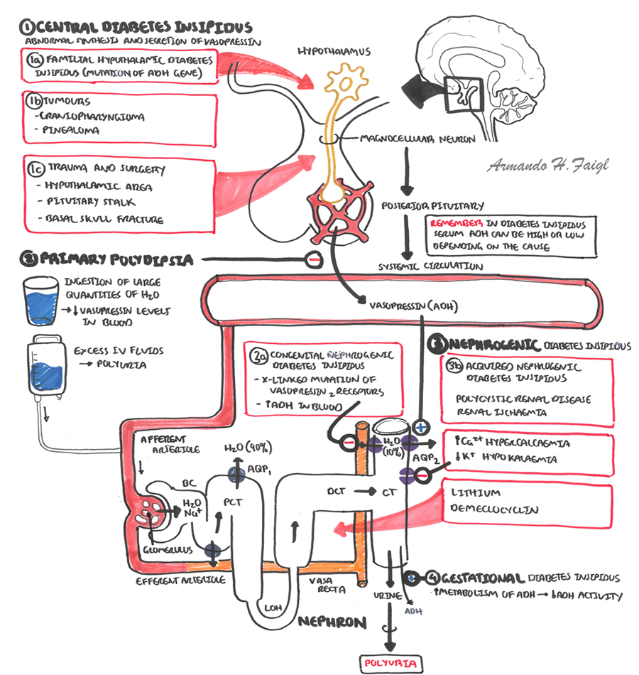 diabetes insipidus centralis hypernatriämie