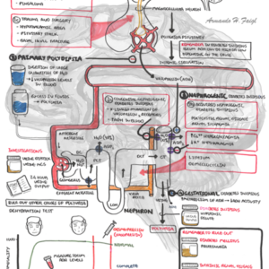 Diabetes Insipidus - Personal use