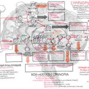 Lymphoma - Personal use