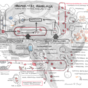 Haemolytic Anaemia - Personal use