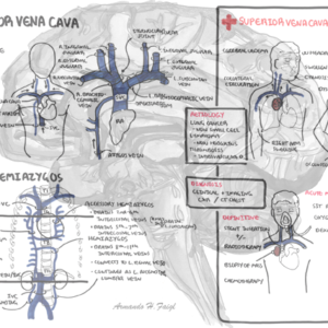 SVC anatomy and obstruction - Personal use