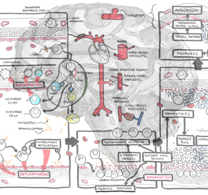 Vasculitis Pathophysiology - Personal use