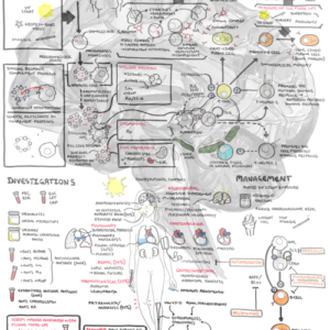 Systemic Lupus Erythematosus - Personal use