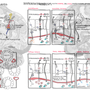 Hyperthyroidism Pathophysiology - Personal use