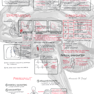 COPD - DETAILED - Personal use