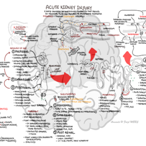 Acute Kidney Injury - Personal use