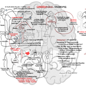 Cardiorenal Syndrome - Personal use