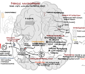 Febrile Neutropaenia - Personal use