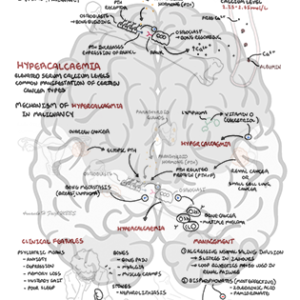 Hypercalcaemia in Malignancy - Personal use