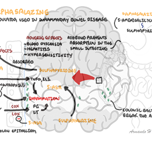 Sulphasalazine - Personal use