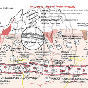 Understanding Inflammation - the Inflammatory response - Personal use