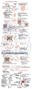 Preview of our Upper GI Bleeding Overview detailed PDF diagram from armandoh.org Ideal for medical professionals and students