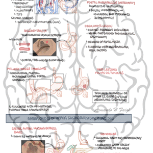 Preview of our Upper GI Bleeding Overview detailed PDF diagram from armandoh.org Ideal for medical professionals and students