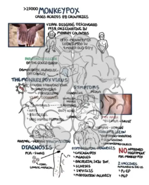 Monkey pox infographic thumbnail by armando hasudungan