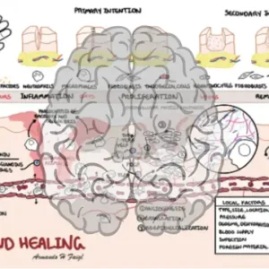 Wound Healing - Personal use