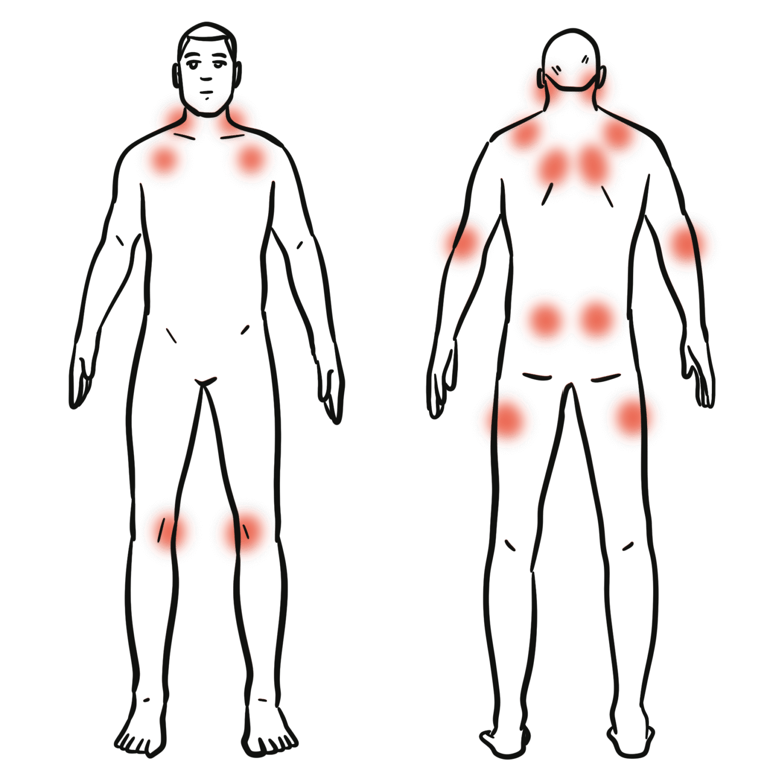 Chronic Widespread Pain Armando Hasudungan chronic-widespread-pain-armando-hasudungan