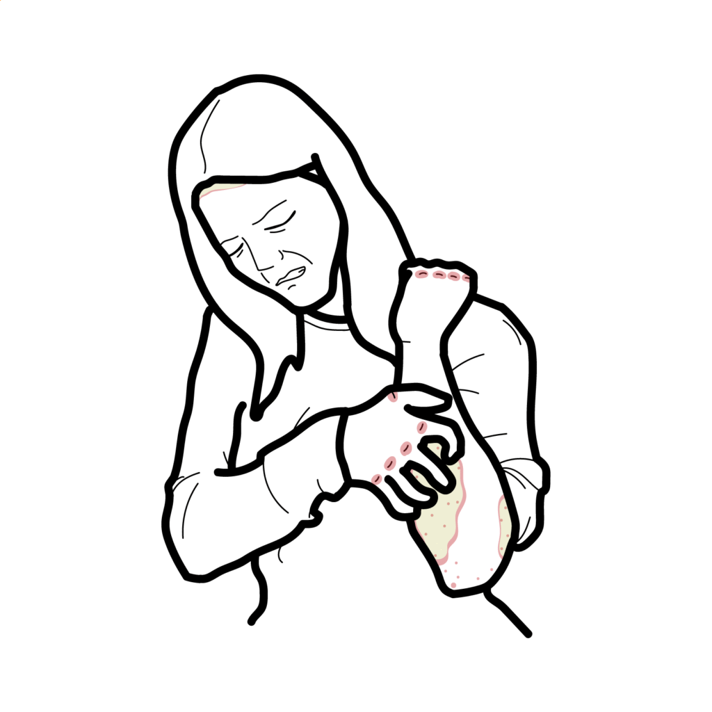 Hydroxyapatite Deposition Disease - Armando Hasudungan